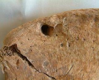 Il gladiatore di York e il leone, nello scheletro la prova delle lotte uomo-animali