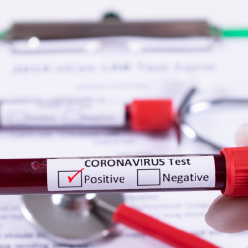 Covid, semplificate in Piemonte le procedure di isolamento e quarantena