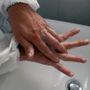 Giornata mondiale dell’igiene delle mani: i consigli dell'Asl Vco
