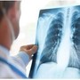 Cancro polmone Egfr-mutato, studio fase 3 Adaura: "Il 79% dei pazienti vivo a 8 anni con Osimertinib" Cancro polmone Egfr-mutato, studio fase 3 Adaura: "Il 79% dei pazienti vivo a 8 anni con Osimertinib"