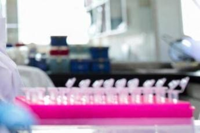 Milano, focolaio di tubercolosi all'Istituto di Medicina legale: 8 casi conclamati e 7 positivi. Indagini sull'origine del contagio Milano, focolaio di tubercolosi all'Istituto di Medicina legale: 8 casi conclamati e 7 positivi. Indagini sull'origine del contagio