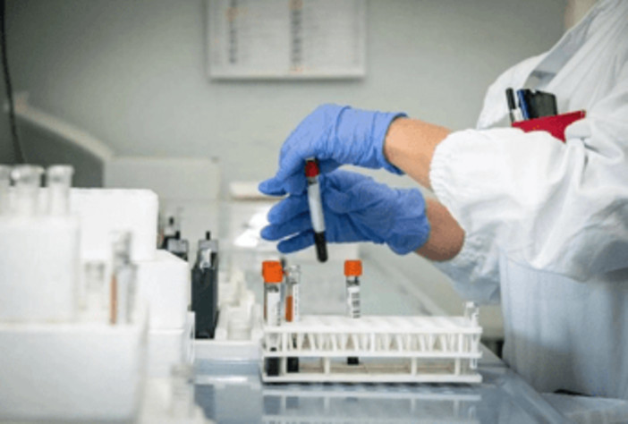 Alzheimer, test del sangue possono prevedere l'inizio dei sintomi Alzheimer, test del sangue possono prevedere l'inizio dei sintomi