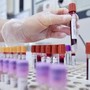 Dal microbiota una speranza contro l'epilessia resistente, lo studio italiano Dal microbiota una speranza contro l'epilessia resistente, lo studio italiano