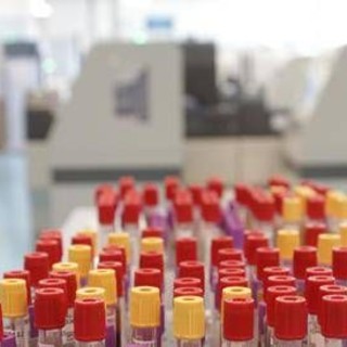 Cos'è il batterio mangiacarne trovato nello Stretto di Messina, minaccia in crescita per il caldo record Cos'è il batterio mangiacarne trovato nello Stretto di Messina, minaccia in crescita per il caldo record