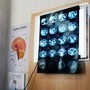 Di Battista, cosa indica un mal di testa forte e improvviso: le ipotesi del neurologo Di Battista, cosa indica un mal di testa forte e improvviso: le ipotesi del neurologo