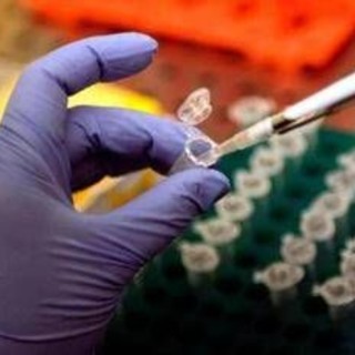 Intossicazione da botulino, sul food truck di Diamante più cibi contaminati: le analisi