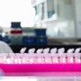 Milano, focolaio di tubercolosi all'Istituto di Medicina legale: 8 casi conclamati e 7 positivi. Indagini sull'origine del contagio