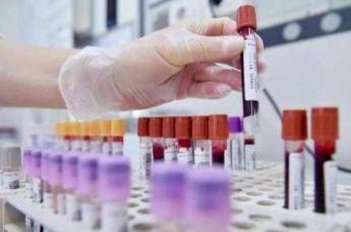 Tumori, cancro vescica: 70% pazienti libero da malattia a 2 anni con terapie perioperatorie Tumori, cancro vescica: 70% pazienti libero da malattia a 2 anni con terapie perioperatorie